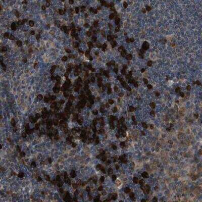 Immunohistochemistry-Paraffin: SSR3 Antibody [NBP1-80667]