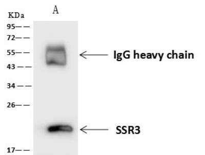 Immunoprecipitation: SSR3 Antibody [NBP2-97569]