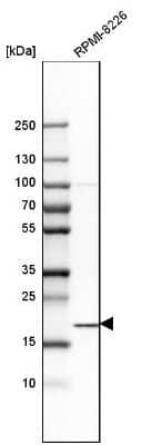 Western Blot: SSR3 Antibody [NBP1-80667]