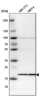 Western Blot: SSR3 Antibody [NBP1-80667]