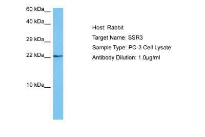 Western Blot: SSR3 Antibody [NBP2-83597]