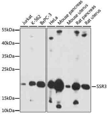 Western Blot: SSR3 AntibodyAzide and BSA Free [NBP2-94450]