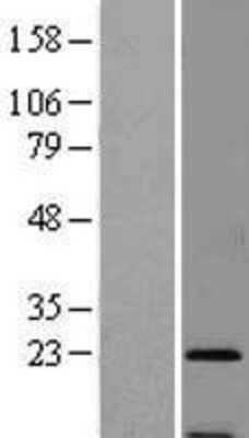 Western Blot: SSR3 Overexpression Lysate [NBL1-16474]