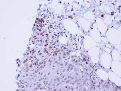 Immunohistochemistry-Paraffin: SSRP1 Antibody [NBP1-33235]