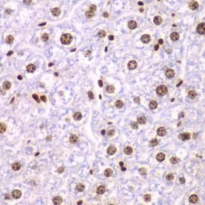 Immunohistochemistry-Paraffin: SSRP1 Antibody - Azide and BSA Free [NBP2-93977]