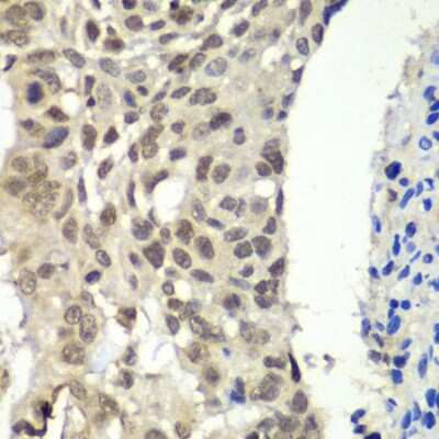 Immunohistochemistry-Paraffin: SSRP1 Antibody - Azide and BSA Free [NBP2-94578]