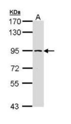 Western Blot: SSRP1 Antibody [NBP1-33235]