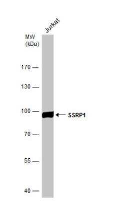 Western Blot: SSRP1 Antibody [NBP1-33235]