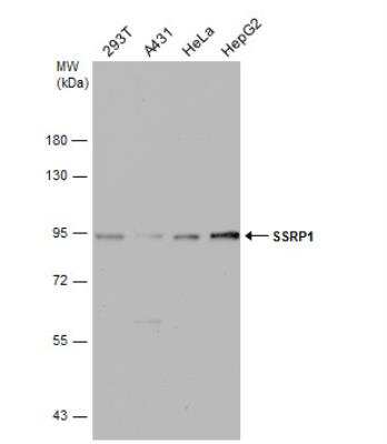 Western Blot: SSRP1 Antibody [NBP1-33235]