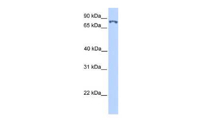 Western Blot: SSRP1 Antibody [NBP2-85824]