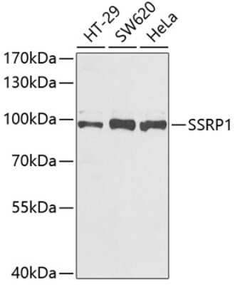 Western Blot: SSRP1 AntibodyAzide and BSA Free [NBP2-93977]