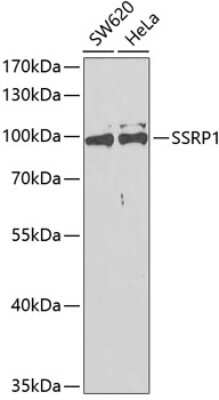 Western Blot: SSRP1 AntibodyAzide and BSA Free [NBP2-94578]