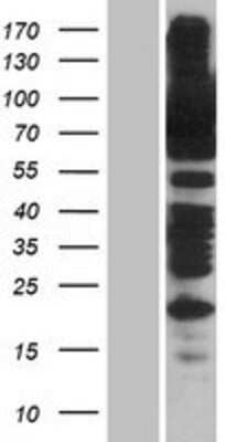 Western Blot: SSRP1 Overexpression Lysate [NBP2-08033]