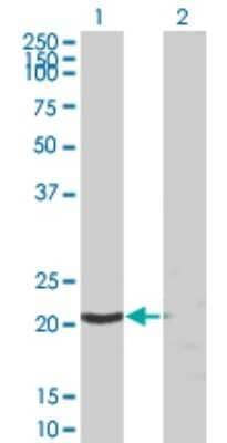 Western Blot: SSSCA1 Antibody (2H4) [H00010534-M03]