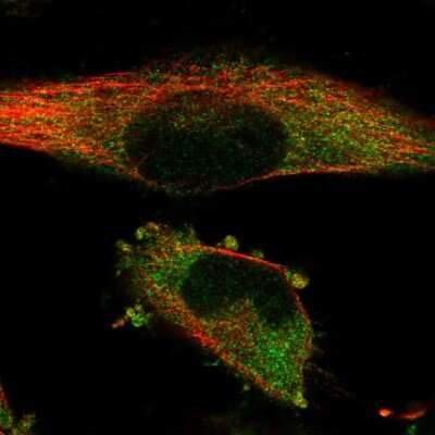 Immunocytochemistry/ Immunofluorescence: SSSCA1 Antibody [NBP2-13387]