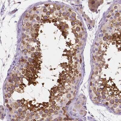 Immunocytochemistry/ Immunofluorescence: SSSCA1 Antibody [NBP2-68820]