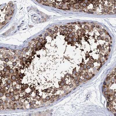 Immunohistochemistry-Paraffin: SSSCA1 Antibody [NBP2-13387]