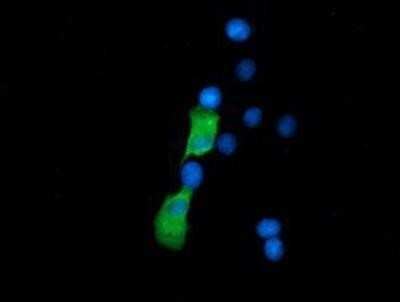 Immunocytochemistry/ Immunofluorescence: SSSCA1 Antibody (OTI2F5) - Azide and BSA Free [NBP2-74359]