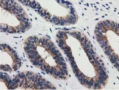 Immunohistochemistry: SSSCA1 Antibody (OTI2F5) - Azide and BSA Free [NBP2-74359]