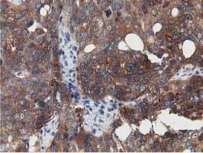 Immunohistochemistry: SSSCA1 Antibody (OTI2F5) - Azide and BSA Free [NBP2-74359]