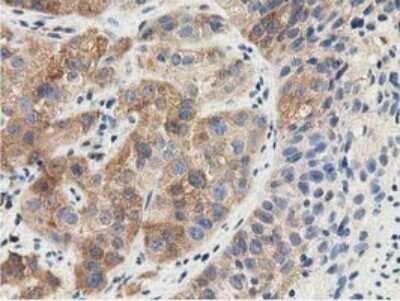 Immunohistochemistry: SSSCA1 Antibody (OTI2F5) - Azide and BSA Free [NBP2-74359]