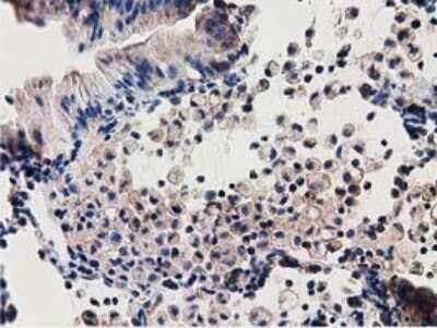 Immunohistochemistry: SSSCA1 Antibody (OTI2F5) - Azide and BSA Free [NBP2-74359]