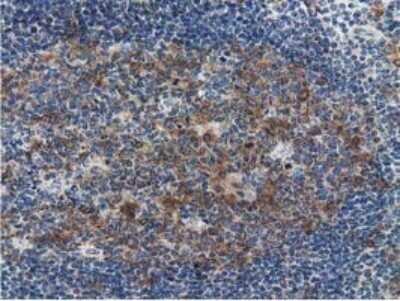 Immunohistochemistry: SSSCA1 Antibody (OTI2F5) - Azide and BSA Free [NBP2-74359]