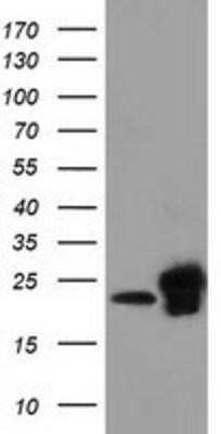 Western Blot: SSSCA1 Antibody (OTI2F5)Azide and BSA Free [NBP2-74359]