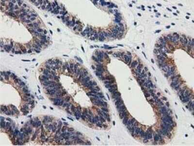 Immunohistochemistry-Paraffin: SSSCA1 Antibody (OTI2F5) [NBP2-03198]