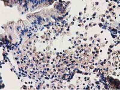 Immunohistochemistry-Paraffin: SSSCA1 Antibody (OTI2F5) [NBP2-03198]