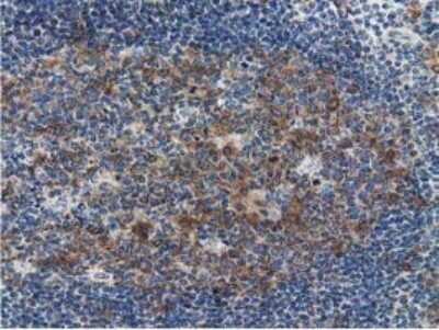 Immunohistochemistry-Paraffin: SSSCA1 Antibody (OTI2F5) [NBP2-03198]