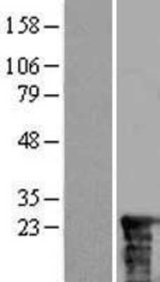 Western Blot: SSSCA1 Overexpression Lysate [NBL1-16476]