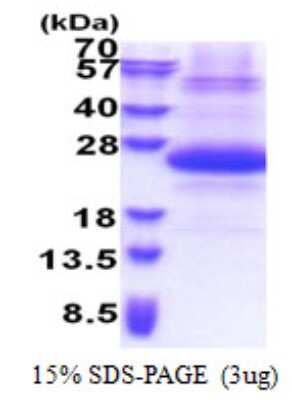 SDS-PAGE: Recombinant Human SSSCA1 His Protein [NBP2-22811]