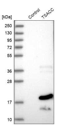 Western Blot: SSTK-IP Antibody [NBP2-33923]