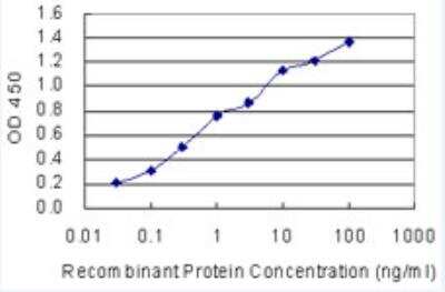 ELISA: SSX1 Antibody (5B2) [H00006756-M01-100ug]