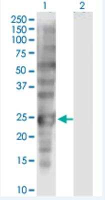 Western Blot: SSX1 Antibody (5B2) [H00006756-M01-100ug]