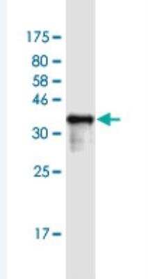 Western Blot: SSX1 Antibody (5B2) [H00006756-M01-100ug]