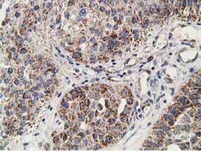 Immunohistochemistry: SSX1 Antibody (OTI1E10) - Azide and BSA Free [NBP2-74362]