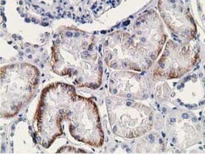 Immunohistochemistry: SSX1 Antibody (OTI1E10) - Azide and BSA Free [NBP2-74362]