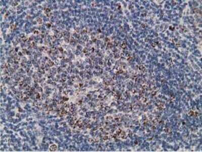 Immunohistochemistry: SSX1 Antibody (OTI1E10) - Azide and BSA Free [NBP2-74362]