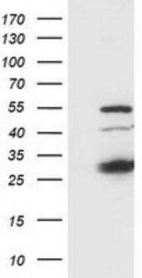 Western Blot: SSX1 Antibody (OTI1E10)Azide and BSA Free [NBP2-74362]