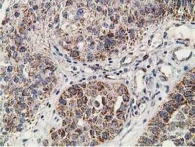 Immunohistochemistry-Paraffin: SSX1 Antibody (OTI1E10) [NBP2-00614]