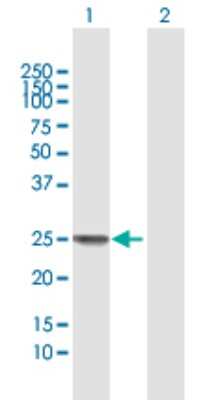 Western Blot: SSX1 Antibody [H00006756-B01P]