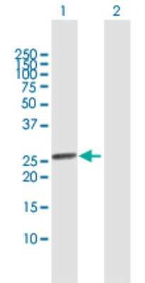 Western Blot: SSX1 Antibody [H00006756-B02P]