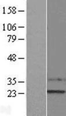 Western Blot: SSX1 Overexpression Lysate [NBL1-16483]