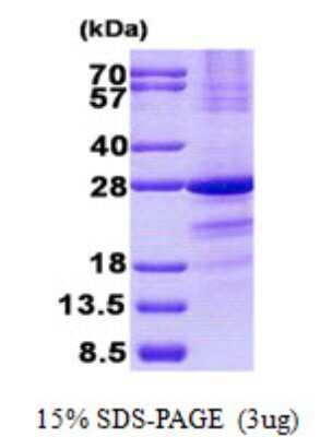 SDS-PAGE: Recombinant Human SSX1 His Protein [NBP2-22841]