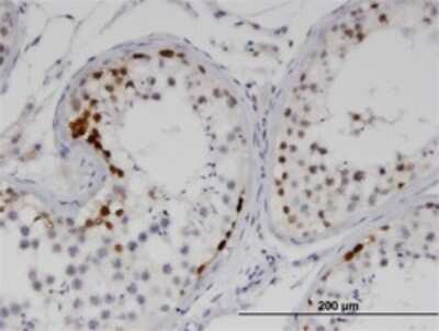 Immunohistochemistry-Paraffin: SSX2 Antibody (1A4) [H00006757-M01]