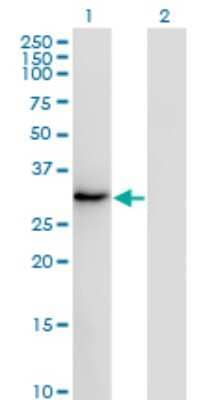 Western Blot: SSX2 Antibody (1A4) [H00006757-M01]