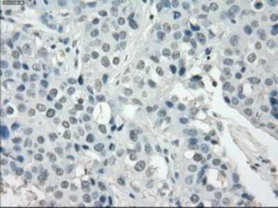 Immunohistochemistry-Paraffin: SSX2 Antibody (OTI4D10) [NBP1-48008]