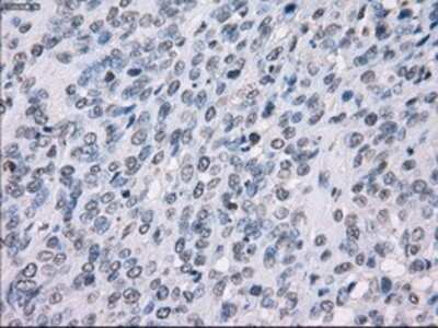 Immunohistochemistry-Paraffin: SSX2 Antibody (OTI4D10) [NBP1-48008]